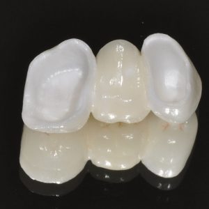 Zirconia fixed dental bridge